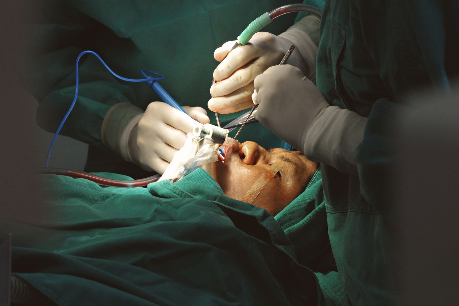 Yüz Gençleştirme Sanatı: Facelift Nedir ve Modern Estetik Yaklaşımlar